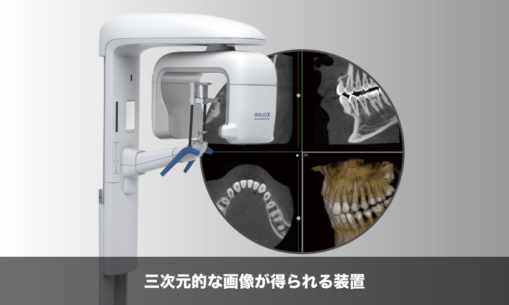 歯科用CT