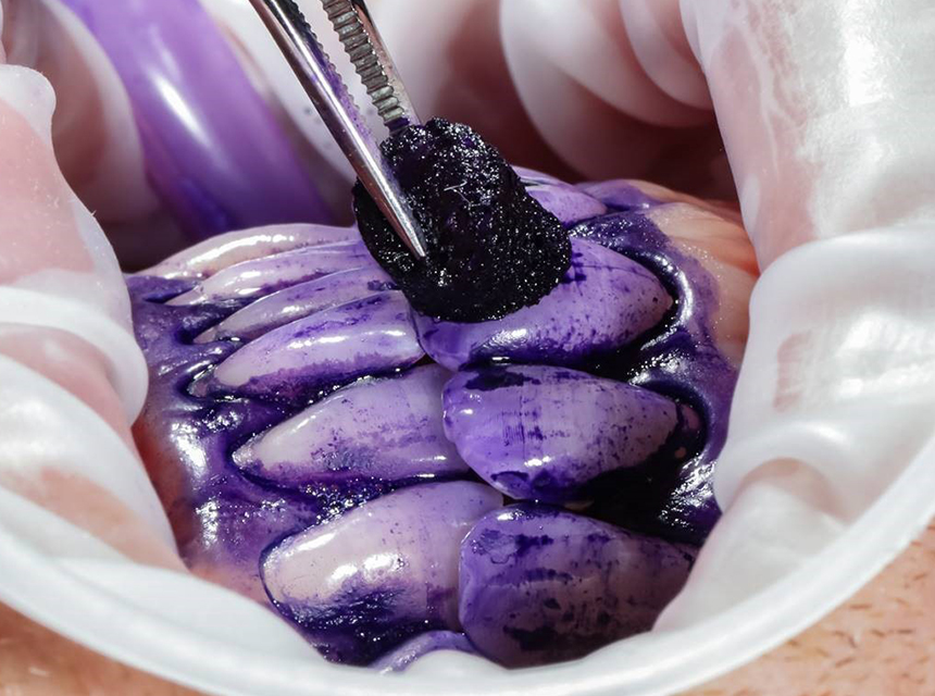 2バイオフィルムの染め出し