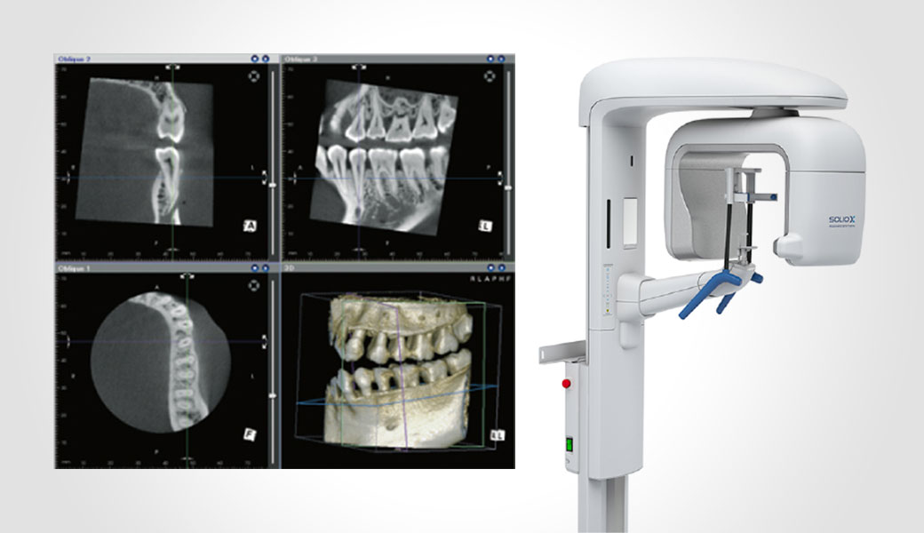 正確な診断を可能にする歯科用CT 