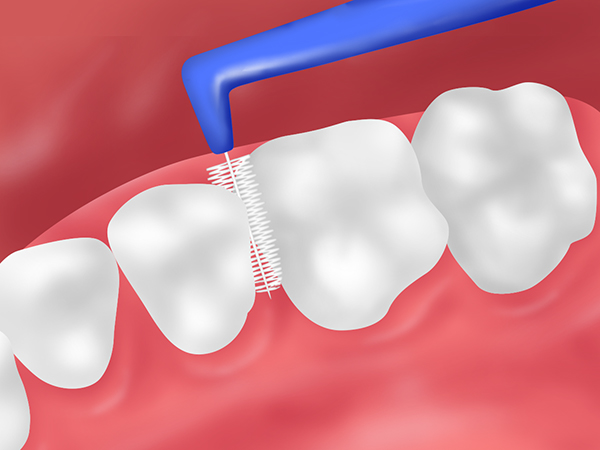 歯間ブラシ・デンタルフロス